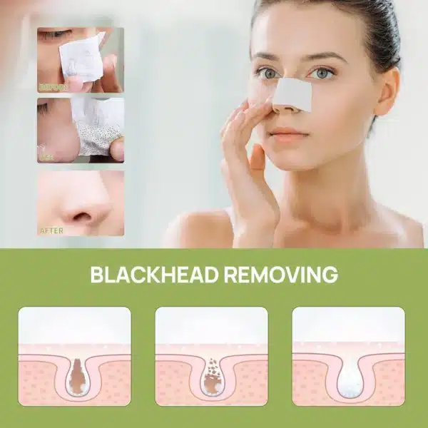 Lanbena Blackheads Removal Nose Plants Pore Strips - Image 3