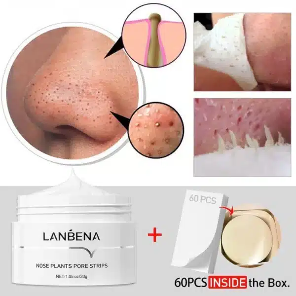 Lanbena Blackheads Removal Nose Plants Pore Strips
